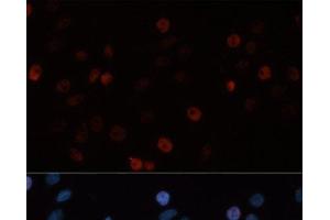 Immunofluorescence analysis of HeLa cells using DNMT3B Polyclonal Antibody at dilution of 1:100. (DNMT3B antibody)