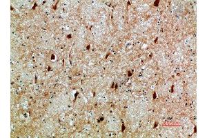 Immunohistochemical analysis of paraffin-embedded human-brain, antibody was diluted at 1:200 (NFAT5 antibody  (AA 1268-1341))