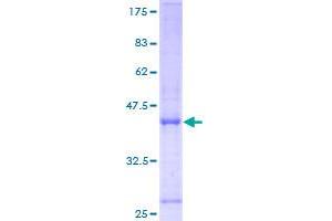 HYOU1 Protein (AA 1-147) (GST tag)