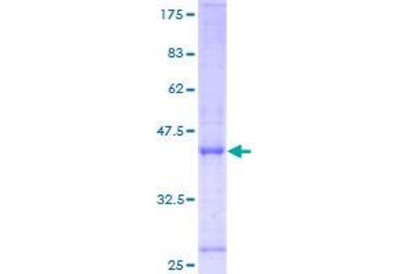 HYOU1 Protein (AA 1-147) (GST tag)