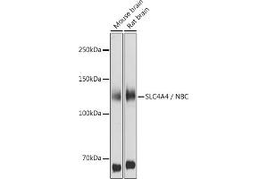 Western blot analysis of extracts of various cell lines, using SLC4 / NBC antibody (ABIN6129130, ABIN6148013, ABIN6148014 and ABIN6220962) at 1:1000 dilution. (SLC4A4 antibody  (AA 1-240))