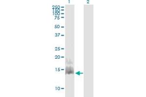 Western Blot analysis of CCL28 expression in transfected 293T cell line by CCL28 monoclonal antibody (M03), clone 3A7. (CCL28 antibody  (AA 24-127))