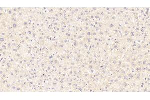 Immunohistochemistry (IHC) image for anti-Reelin (RELN) (AA 3143-3461) antibody (ABIN7435136)