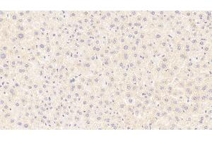 Detection of RELN in Mouse Liver Tissue using Polyclonal Antibody to Reelin (RELN) (Reelin antibody  (AA 3143-3461))