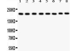 Anti- TJP1 antibody, Western blotting All lanes: Anti TJP1  at 0. (TJP1 antibody  (AA 1178-1527))