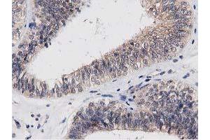 Image no. 7 for anti-Acyl-CoA Thioesterase 12 (ACOT12) antibody (ABIN1496414) (ACOT12 antibody)