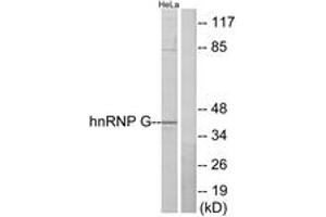 Western blot analysis of extracts from HeLa cells, using hnRNP G Antibody.