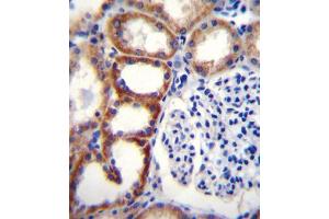 Immunohistochemistry (IHC) image for anti-Succinate Dehydrogenase Complex, Subunit D, Integral Membrane Protein (SDHD) antibody (ABIN2996554) (SDHD antibody)