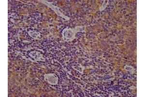IHC image of ABIN7149098 diluted at 1:200 and staining in paraffin-embedded human lymph node tissue performed on a Leica BondTM system.