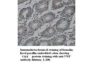 Image no. 1 for anti-Von Willebrand Factor (VWF) (Internal Region) antibody (ABIN791020) (VWF antibody  (Internal Region))