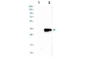 Western blot analysis of Lane 1: Negative control (vector only transfected HEK293T lysate), Lane 2: Over-expression Lysate (Co-expressed with a C-terminal myc-DDK tag (~3. (Tropomyosin antibody  (AA 128-243))