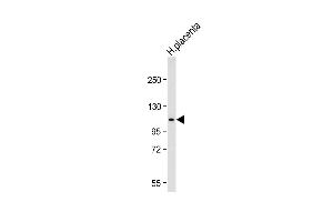 Western blot analysis of lysate from Jurkat cell line, using G Antibody (N-term) (ABIN656475 and ABIN2845755). (GAA antibody  (N-Term))