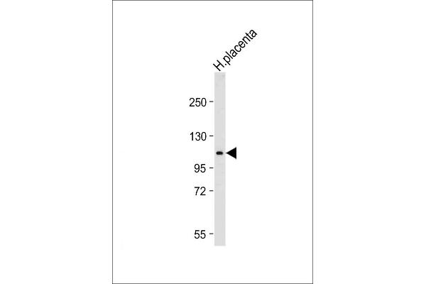 GAA anticorps  (N-Term)