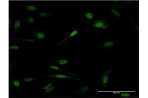 Immunofluorescence (IF) image for anti-PR Domain Containing 1, with ZNF Domain (PRDM1) (AA 422-493) antibody (ABIN513732)