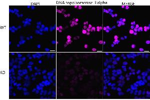 Immunocytochemical staining of HeLa cells using DNA topoisomerase II alpha antibody (ABIN7800574), 1:1,000), Top panel: wild-type (WT), Bottom panal: DNA topoisomerase II alpha shRNA knockdown (KD). (Recombinant Topoisomerase II alpha antibody)
