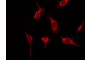OR51A2 antibody  (Internal Region)