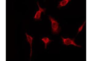 ABIN6276161 staining Hela by IF/ICC. (OR51A2 antibody  (Internal Region))