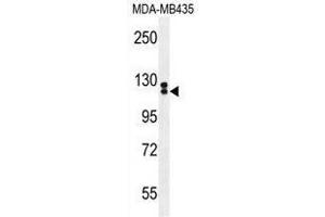 TTLL13 Antibody (Center) western blot analysis in MDA-MB435 cell line lysates (35 µg/lane). (TTLL13 antibody  (Middle Region))