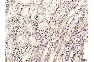 Formalin-fixed and paraffin embedded: human stomach tissue labeled with Anti-GLP-2 Polyclonal Antibody, Unconjugated (ABIN726305) at 1:200, followed by conjugation to the secondary antibody and DAB staining (GLP-2 antibody  (AA 146-165))