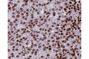 Histone H3 Antibody for IHC in human testis (Histone 3 antibody)