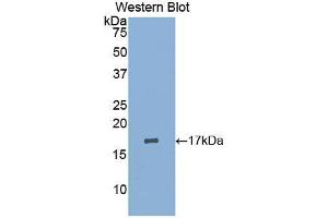 Western blot analysis of the recombinant protein. (LIFR antibody  (AA 45-184))