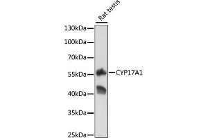 Western blot analysis of extracts of rat testis, using CYP17 antibody (373) at 1:500 dilution. (CYP17A1 antibody  (AA 209-508))