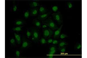 Immunofluorescence of monoclonal antibody to HIPK1 on HeLa cell. (HIPK1 antibody  (AA 330-430))