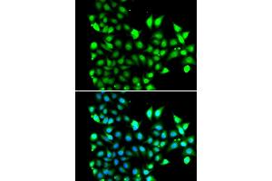 Immunofluorescence analysis of MCF7 cell using SNRPD2 antibody. (SNRPD2 antibody)