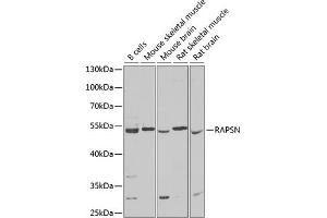 Western blot analysis of extracts of various cell lines, using RAPSN Antibody (ABIN6132583, ABIN6146690, ABIN6146691 and ABIN6222434) at 1:1000 dilution. (RAPSN antibody  (AA 1-353))