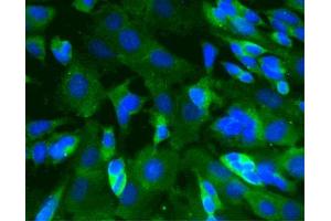 Immunofluorescence staining of SK-N-SH cells (Human neuroblastoma, ATCC HTB-11) (Second Panel). (CAMK2A antibody  (AA 448-460))