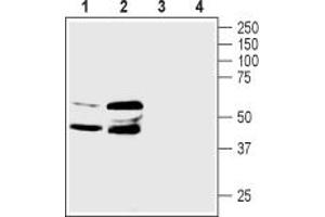 anti-Prostaglandin E Receptor 3 (Subtype EP3) (PTGER3) (AA 137-149), (Cytoplasmic) antibody