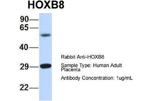 Host: Rabbit Target Name: HOXB8 Sample Type: Human Adult Placenta Antibody Dilution: 1. (HOXB8 antibody  (N-Term))