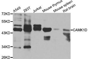 Western blot analysis of extracts of various cell lines, using CAMK1D antibody. (CAMK1D antibody)