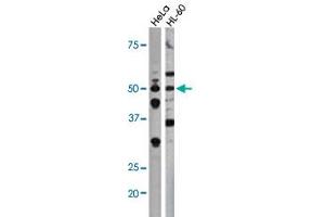 The CDC25A (phospho S75) polyclonal antibody  is used in Western blot to detect Phospho-CDC25A-S75 in Hela (left) and HL-60 (right) cell lysates. (CDC25A antibody  (pSer76))
