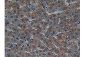 DAB staining on IHC-P; Samples: Human Liver Tissue (Laminin alpha 1 antibody  (AA 2613-2746))