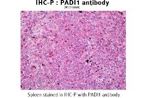 Image no. 3 for anti-Peptidyl Arginine Deiminase, Type I (PADI1) antibody (ABIN346989) (PADI1 antibody)