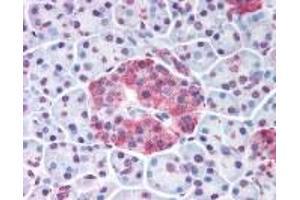 Immunohistochemistry (IHC) image for anti-Wingless-Type MMTV Integration Site Family, Member 10A (WNT10A) (Internal Region) antibody (ABIN2469512) (WNT10A antibody  (Internal Region))