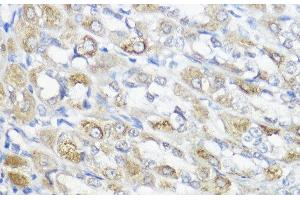 Immunohistochemistry of paraffin-embedded Rat stomach using GPX2 Polyclonal Antibody at dilution of 1:100 (40x lens). (Glutathione Peroxidase 2 antibody)