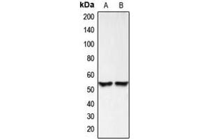 Western blot analysis of BMP3 expression in HEK293T (A), HeLa (B) whole cell lysates.