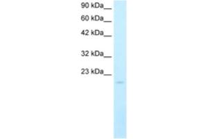 Western Blotting (WB) image for anti-SP140 Nuclear Body Protein (SP140) antibody (ABIN2460593) (SP140 antibody)