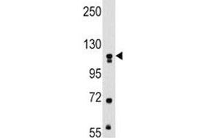 Western blot analysis of MUSK antibody and mouse kidney tissue lysate. (MUSK antibody)