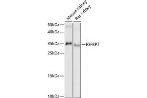 Western blot analysis of extracts of various cell lines, using IGFBP7 antibody (ABIN6131959, ABIN6142263, ABIN6142264 and ABIN6216854) at 1:1000 dilution. (IGFBP7 antibody  (AA 27-282))