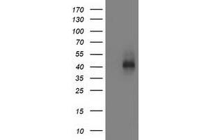 HEK293T cells were transfected with the pCMV6-ENTRY control (Left lane) or pCMV6-ENTRY MSI1 (Right lane) cDNA for 48 hrs and lysed. (MSI1 antibody)
