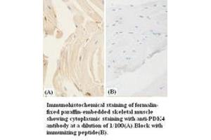 Image no. 1 for anti-Pyruvate Dehydrogenase Kinase, Isozyme 4 (PDK4) antibody (ABIN791131) (PDK4 antibody)