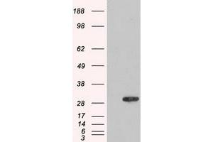 HEK293T cells were transfected with the pCMV6-ENTRY control (Left lane) or pCMV6-ENTRY AK1 (Right lane) cDNA for 48 hrs and lysed. (Adenylate Kinase 1 antibody)