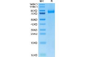 Biotinylated Human CD36 on Tris-Bis PAGE under reduced condition. (CD36 Protein (CD36) (AA 30-439) (His-Avi Tag,Biotin))