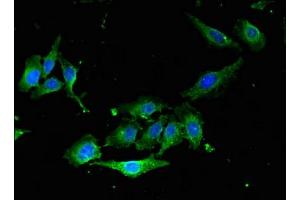 Immunofluorescent analysis of Hela cells using ABIN7167354 at dilution of 1: 100 and Alexa Fluor 488-congugated AffiniPure Goat Anti-Rabbit IgG(H+L) (RAB5 antibody  (AA 1-215))