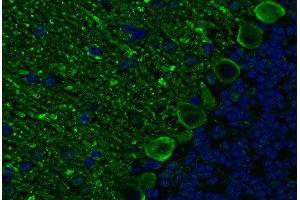 Indirect immunostaining PFA fixed paraffin embedded mouse cerebellum section (dilution 1 : 200; green). (ITPR1 antibody)