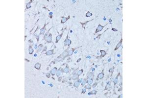 Immunohistochemistry of paraffin-embedded mouse brain using NNMT antibody (ABIN5974021) at dilution of 1/100 (40x lens). (NNMT antibody)