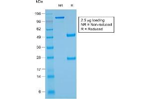 SDS-PAGE Analysis Purified Glycophorin A Mouse Recombinant Monoclonal Ab (rGYPA/280). (Recombinant CD235a/GYPA antibody)